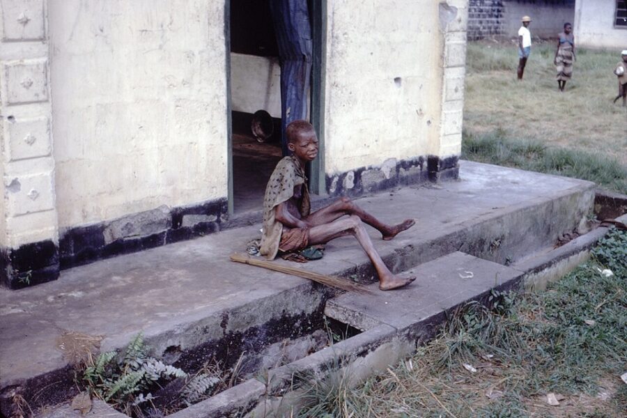 Een ernstig ondervoede Biafraanse vrouw tijdens de oorlog
